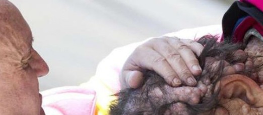 La fotografía que dio la vuelta al mundo y la realidad de la enfermedad